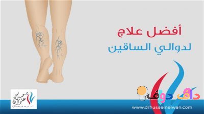 افضل علاج لدوالي الخصية دليل شامل